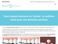 Implant dentaire Tunisie