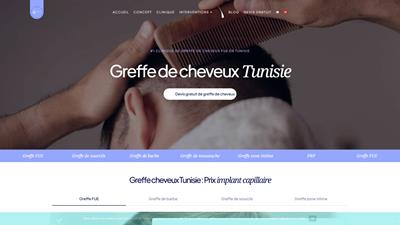 Transplantation de cheveux en Tunisie